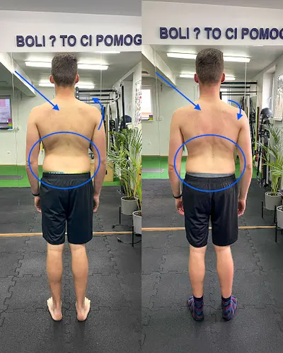 OPTIMOVE - Terapia Bólu i Trening Medyczny Bydgoszcz